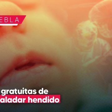 Nueva jornada de cirugías gratuitas para labio y paladar hendido en Puebla