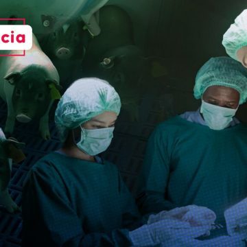 ¡Histórico! Realizan el primer trasplante de un pulmón de cerdo a un humano