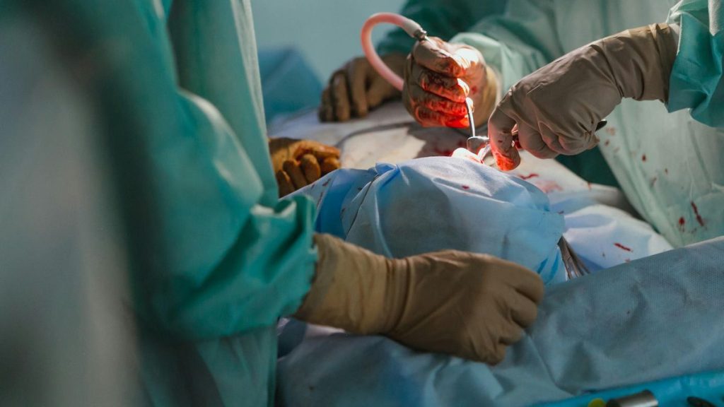 ¡Histórico! Realizan el primer trasplante de un pulmón de cerdo a un humano 1 ¡Histórico! Realizan el primer trasplante de un pulmón de cerdo a un humano
