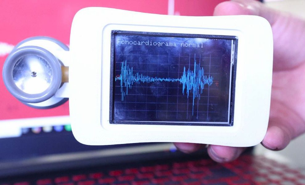 Estetoscopio del IPN permite detectar dano cardiaco con Inteligencia Artificial 3