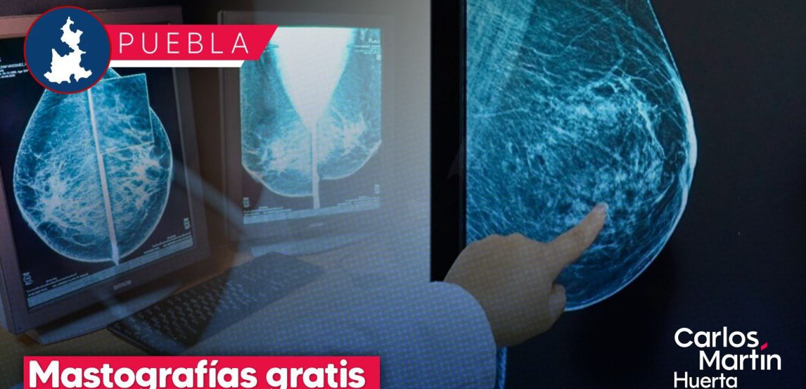 Club Rotario y Cáritas ofrecerán 250 mastografías y ultrasonidos gratis en Puebla