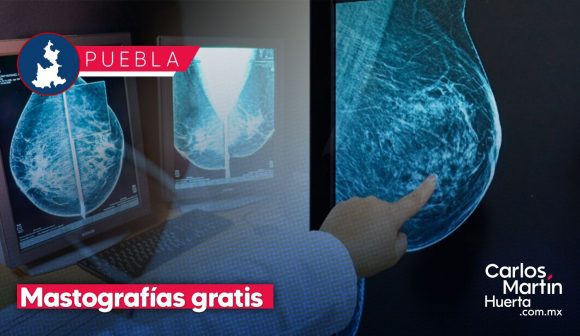 Club Rotario y Cáritas ofrecerán 250 mastografías y ultrasonidos gratis en Puebla