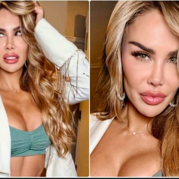 Ninel Conde se convierte en ojiverde con queratopigmentación: “¡Tan Natural!”