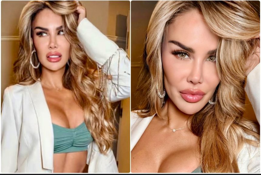 IMG_2348 Ninel Conde se convierte en ojiverde con queratopigmentación: “¡Tan Natural!”
