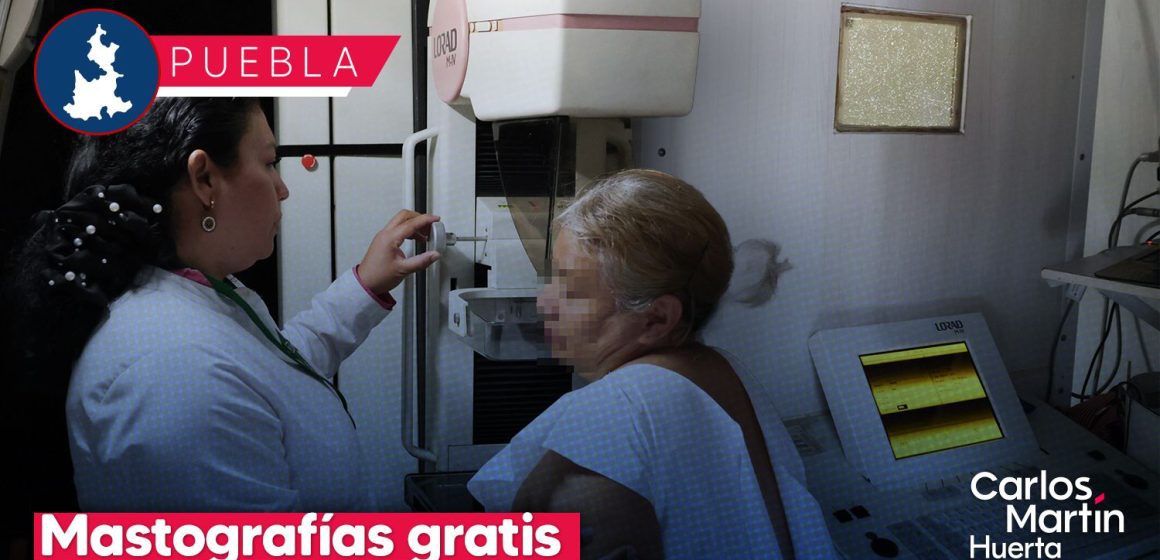 Mastografías gratis en Puebla: Conoce dónde realizarte estudios preventivos contra el cáncer de mama