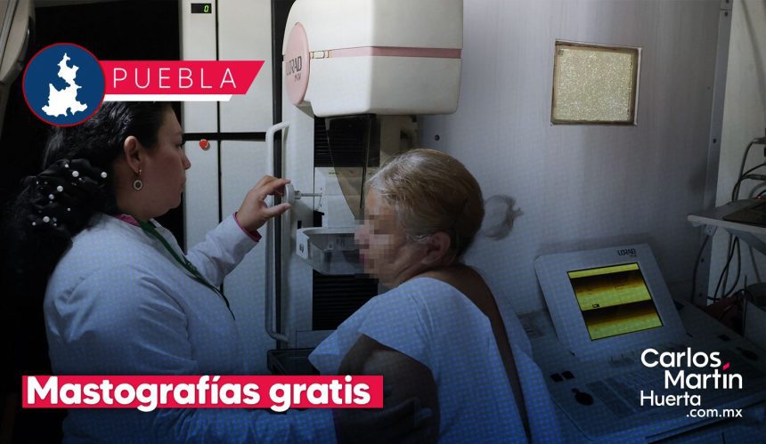 Mastografías gratis en Puebla: Conoce dónde realizarte estudios preventivos contra el cáncer de mama