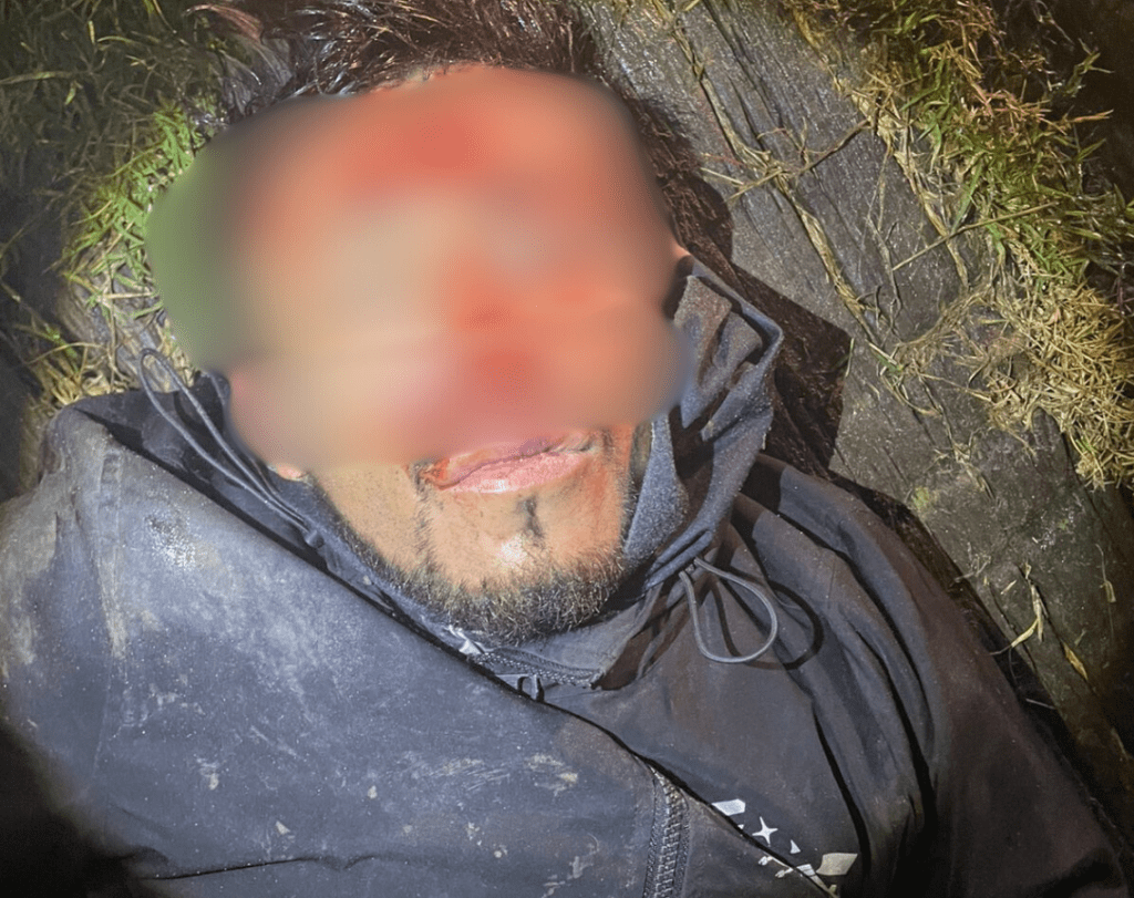 Presunto delincuente fue golpeado y macheteado por vecinos en San Martín Texmelucan 1 macheteado 1