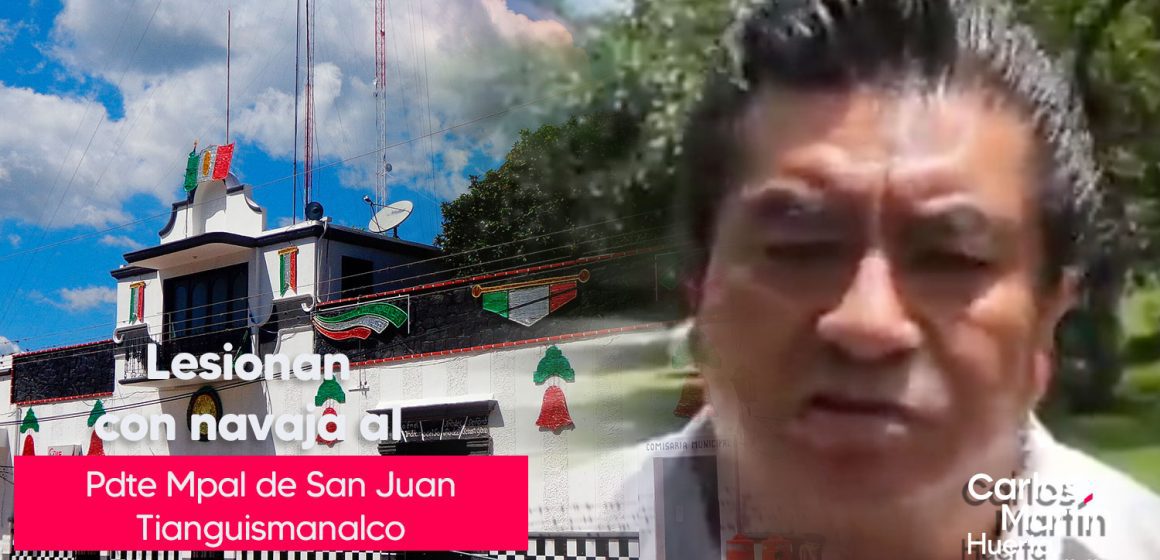 Presidente municipal de San Juan Tianguismanalco, lesionado de gravedad