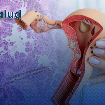 Cáncer de ovario Desarrollan terapia combinada para superar la resistencia a fármacos Cáncer de ovario: Desarrollan terapia combinada para superar la resistencia a fármacos