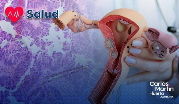 Cáncer de ovario: Desarrollan terapia combinada para superar la resistencia a fármacos