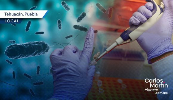 Caso de cólera en Tehuacán; autoridades descartan riesgo