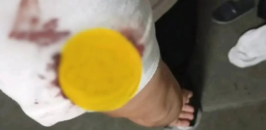 Intento de asalto en la carretera Puebla-Atlixco deja a conductor herido 2 Intento de asalto en la carretera Puebla Atlixco deja a conductor herido 4 1 e1765305682373