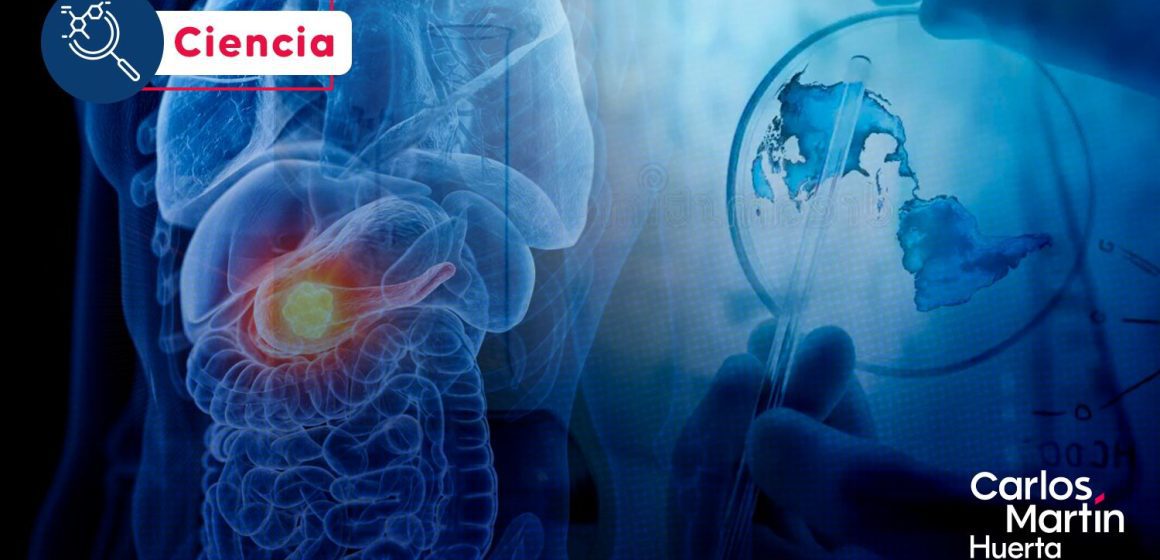 Cáncer de páncreas Científicos españoles desarrollan terapia triple para evitar la resistencia tumoral Cáncer de páncreas: Científicos españoles desarrollan terapia triple para evitar la resistencia tumoral