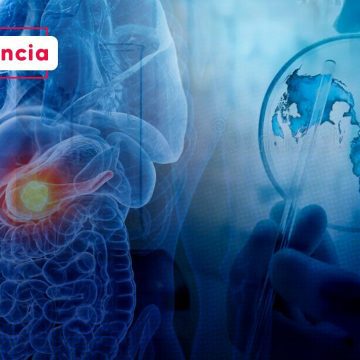 Cáncer de páncreas Científicos españoles desarrollan terapia triple para evitar la resistencia tumoral Cáncer de páncreas: Científicos españoles desarrollan terapia triple para evitar la resistencia tumoral