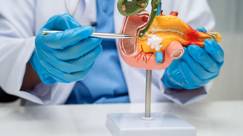 Cáncer de páncreas: Científicos españoles desarrollan terapia triple para evitar la resistencia tumoral 2 Cancer de pancreas Cientificos espanoles desarrollan terapia triple para evitar la resistencia tumoral 2