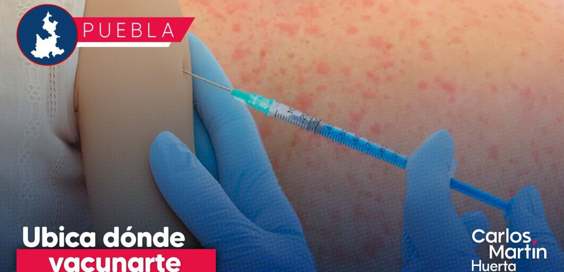 Conoce dónde puedes vacunarte contra el Sarampión en Puebla