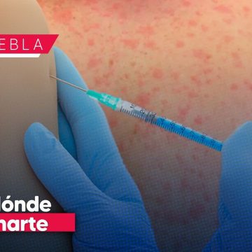 Conoce dónde puedes vacunarte contra el Sarampión en Puebla