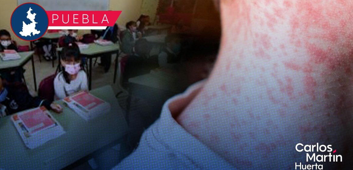 Portada Detectan caso de sarampión en el Centro Escolar Comunitario Sur CMH Detectan caso de sarampión en el Centro Escolar Comunitario Sur