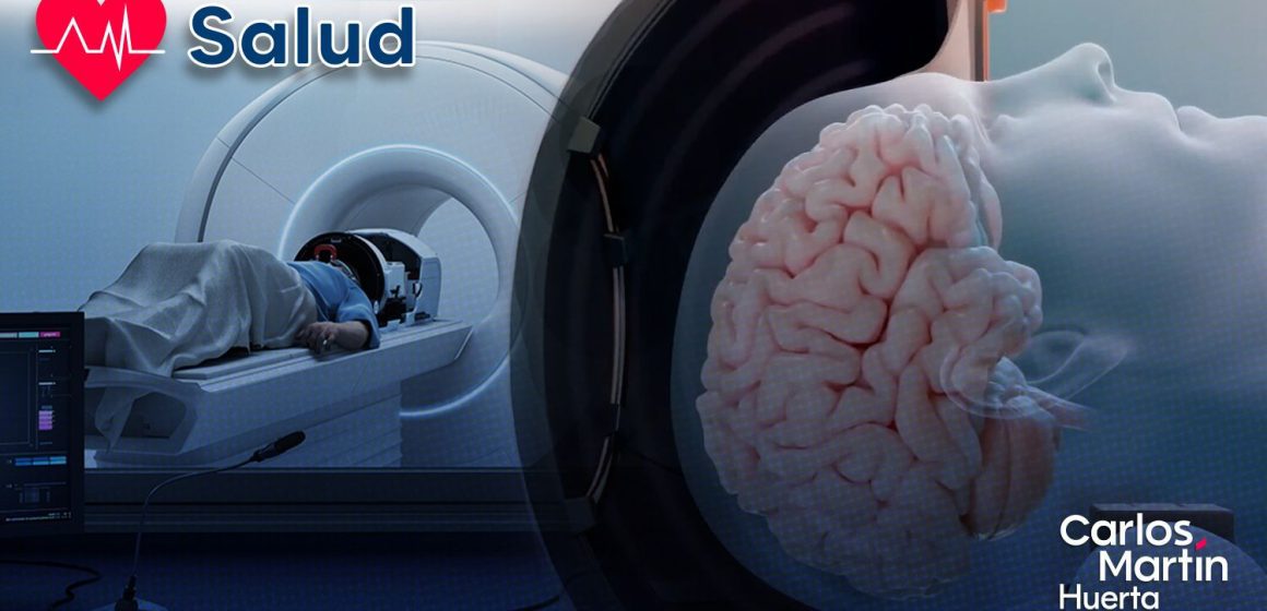 Logran revertir síntomas de Alzheimer con ultrasonidos de alta intensidad Logran revertir síntomas de Alzheimer con ultrasonidos de alta intensidad