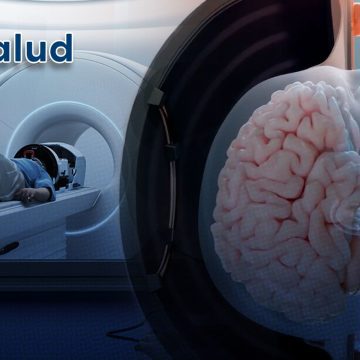 Logran revertir síntomas de Alzheimer con ultrasonidos de alta intensidad