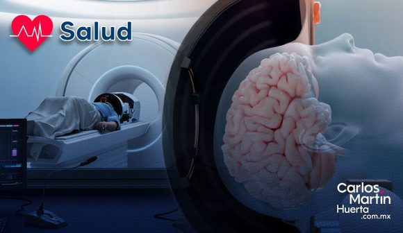 Logran revertir síntomas de Alzheimer con ultrasonidos de alta intensidad