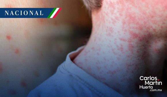 Sarampión en México: Salud anuncia ampliación de estrategia, dispone de 23 millones de vacunas