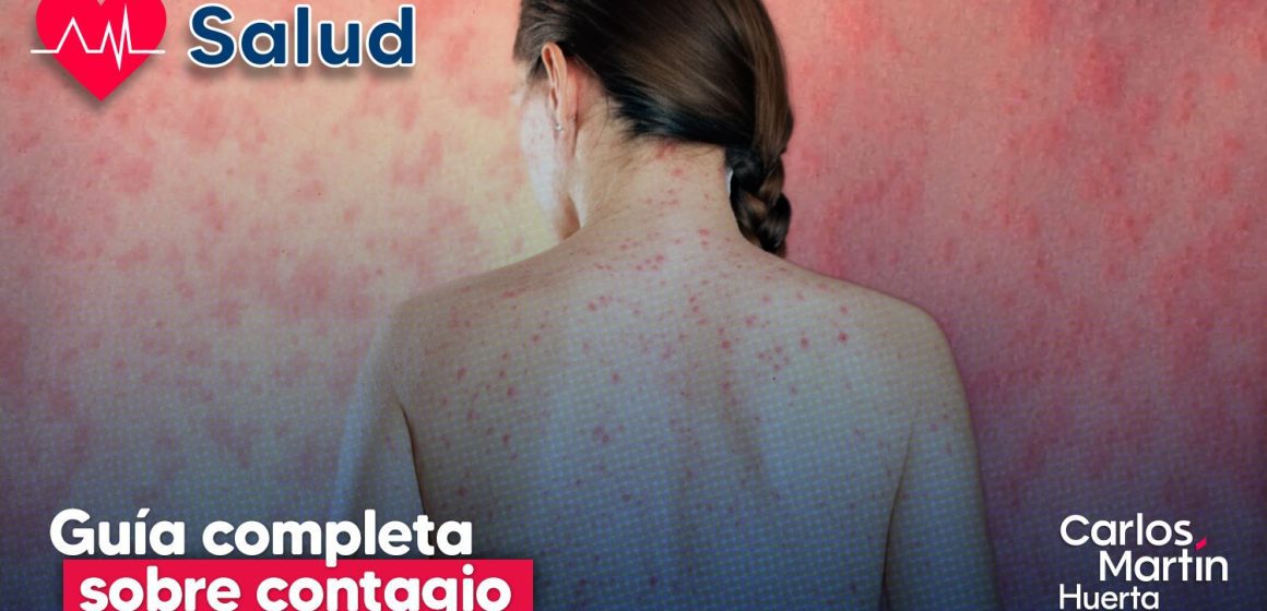 Sarampión en México: Guía sobre contagio, esquema de vacunación y prevención