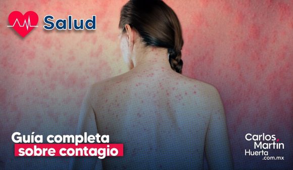 Sarampión en México: Guía sobre contagio, esquema de vacunación y prevención
