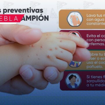 Secretaría de Salud refuerza vigilancia epidemiológica por segundo caso de sarampión en Puebla
