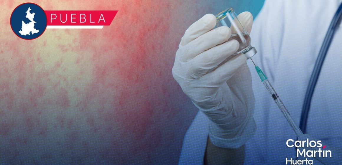 Portada Brote de Sarampión en Puebla Suman 33 casos confirmados y Salud aclara si habrá suspensión de clases CMH Brote de Sarampión en Puebla: Suman 33 casos confirmados y Salud aclara si habrá suspensión de clases