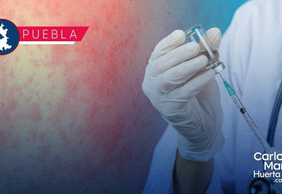 Sarampión en Puebla: 53 casos confirmados en 5 municipios
