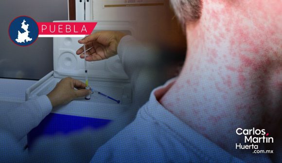 Suman 59 casos de sarampión en Puebla; se extienden a 6 municipios
