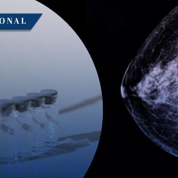 Vacuna de ARNm personalizada muestra resultados positivos contra el cáncer de mama