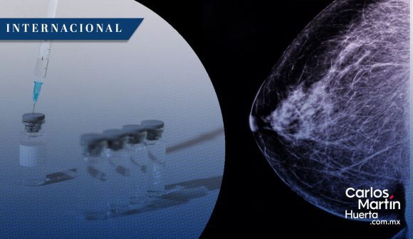 Vacuna de ARNm personalizada muestra resultados positivos contra el cáncer de mama