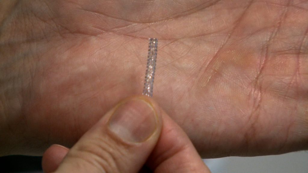 Valladolid y Valencia desarrollan tratamiento contra el infarto