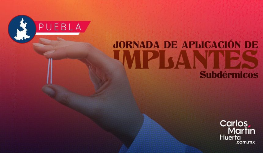 BUAP anuncia Jornada de Aplicación de Implantes Subdérmicos