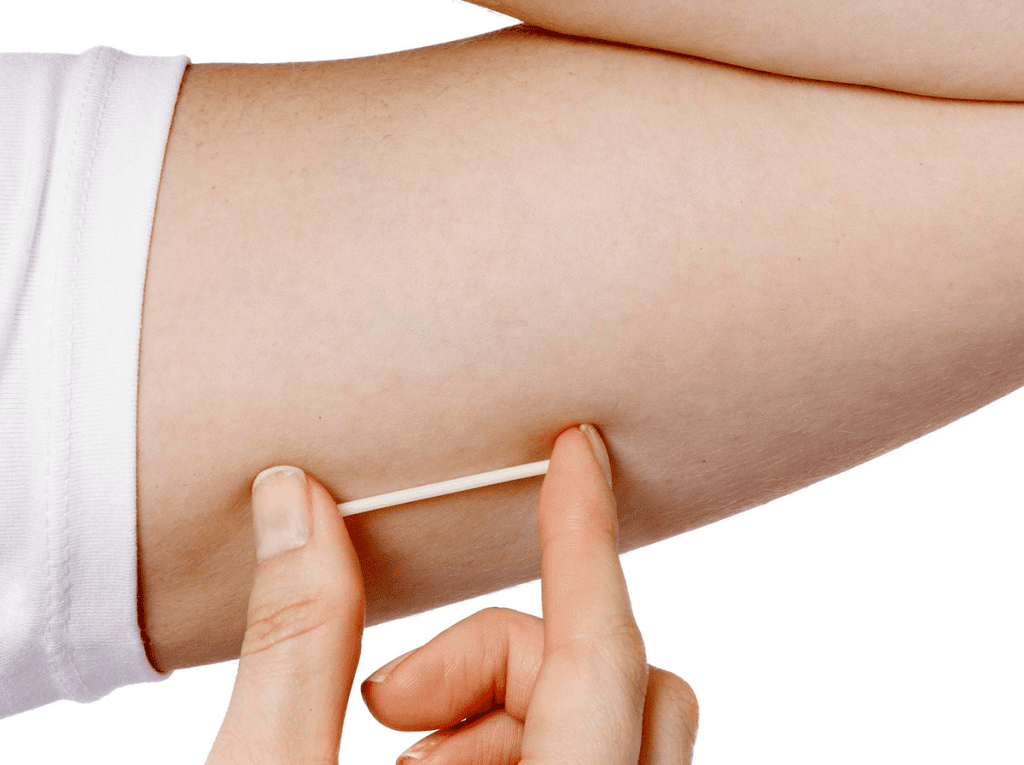 BUAP anuncia Jornada de Aplicacion de Implantes Subdermicos 3