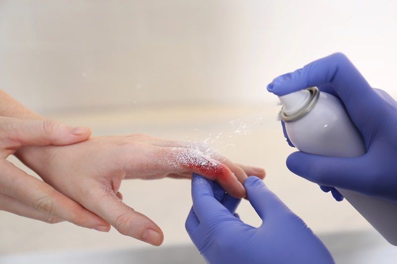 Cientificos coreanos desarrollan un polvo en aerosol que sella heridas mortales 3