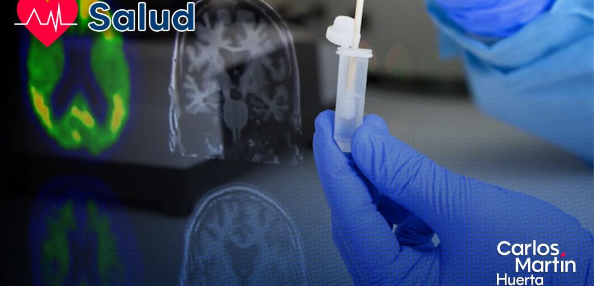 Desarrollan prueba de hisopado nasal para detectar el Alzheimer