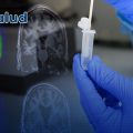 Desarrollan prueba de hisopado nasal para detectar el Alzheimer