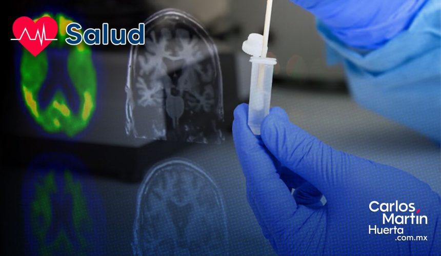Desarrollan prueba de hisopado nasal para detectar el Alzheimer