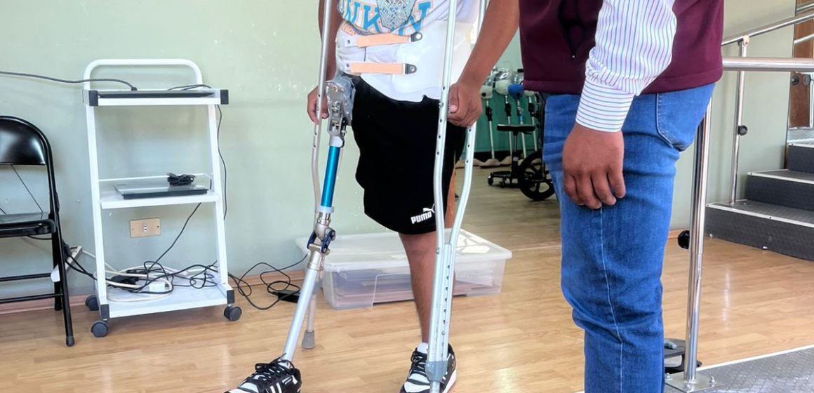 Diego y Don Ranulfo reciben sus prótesis en Huejotzingo