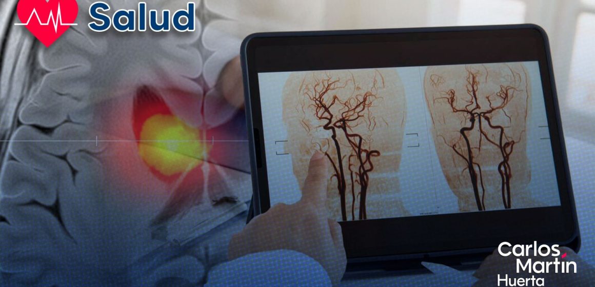 ¡Avance médico! Dispositivo portátil devuelve el habla a pacientes con ictus