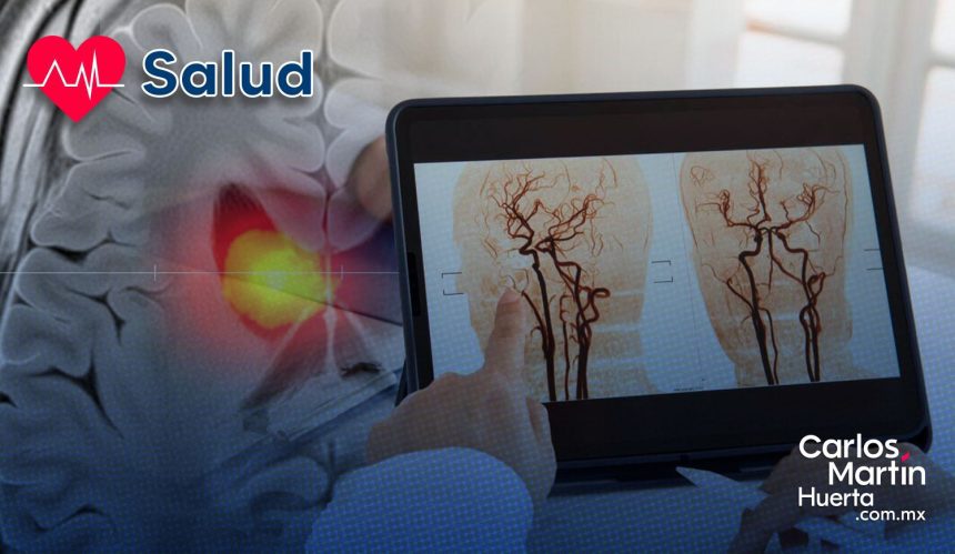 ¡Avance médico! Dispositivo portátil devuelve el habla a pacientes con ictus ¡Avance médico! Dispositivo portátil devuelve el habla a pacientes con ictus