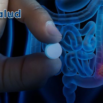 Estudio revela cómo la aspirina podría ayudar a combatir el cáncer colorrectal