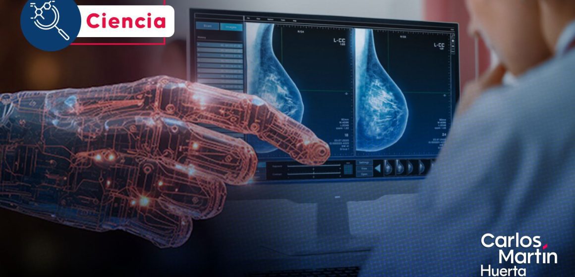 Mamografías con IA: ¿El nuevo estándar para la detección temprana del cáncer?