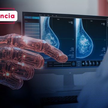 Mamografías con IA: ¿El nuevo estándar para la detección temprana del cáncer?