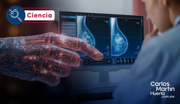 Mamografías con IA: ¿El nuevo estándar para la detección temprana del cáncer?
