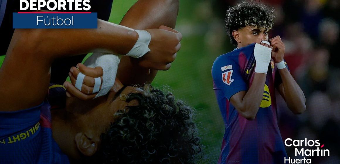 Incertidumbre en Puebla: Lamine Yamal, baja por lesión tras partido vs. Celta de Vigo