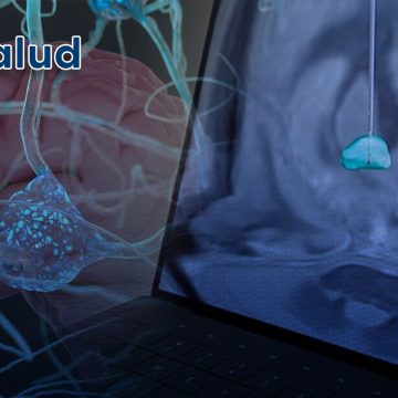 Síndrome de Tourette: La estimulación cerebral profunda podría frenar los tics